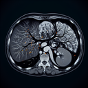 МРТ печінки