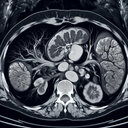 МРТ селезінки