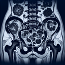 МРТ малого тазу у жінок